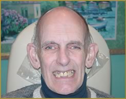 Renton Denture Clinic